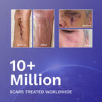 Rejuvaskin Scar Fx Silicone Sheet - 1.5" x 3"