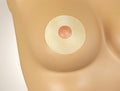 Oleeva® Scar Treatment – Areola Shape