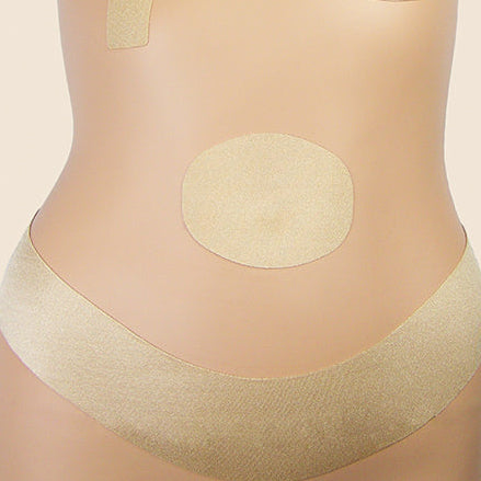 Oleeva® Umbilicoplasty Scar Treatment