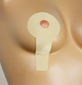 Oleeva®  Vertical Mastopexy Scar Treatment