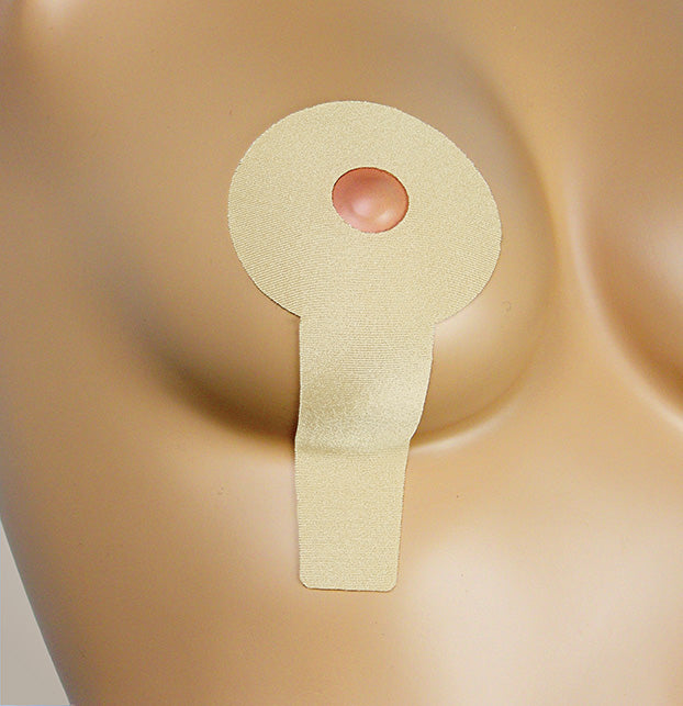 Oleeva®  Vertical Mastopexy Scar Treatment